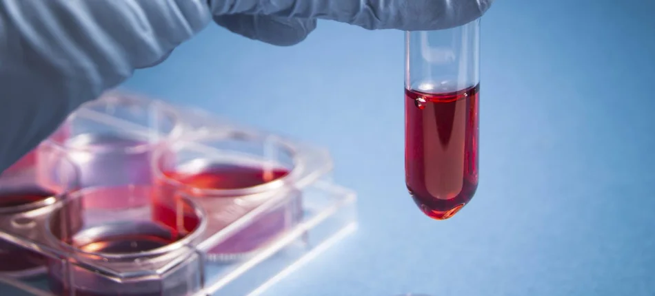 Najnowsze badanie krwi pomoże przewidzieć ryzyko zgonu  - Obrazek nagłówka