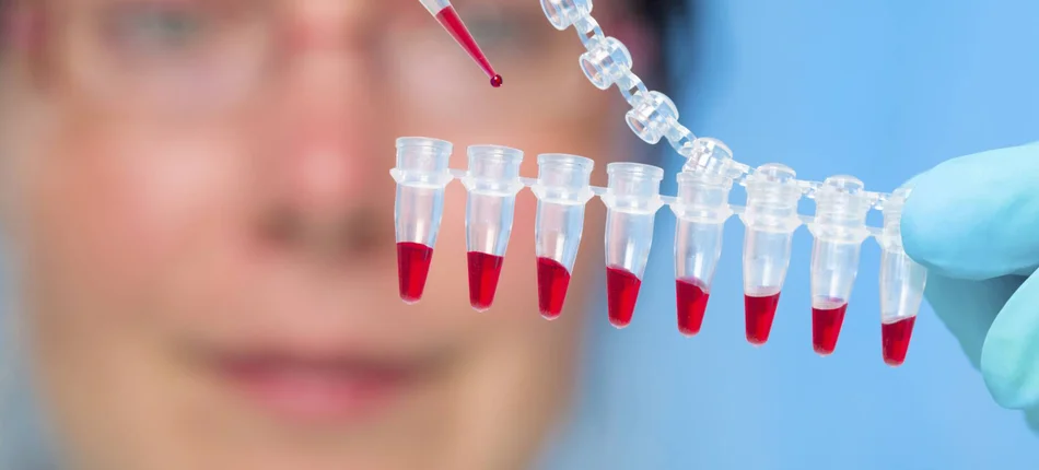 Powstaje obiecujące szczepionka genetyczna przeciwko HIV - Obrazek nagłówka