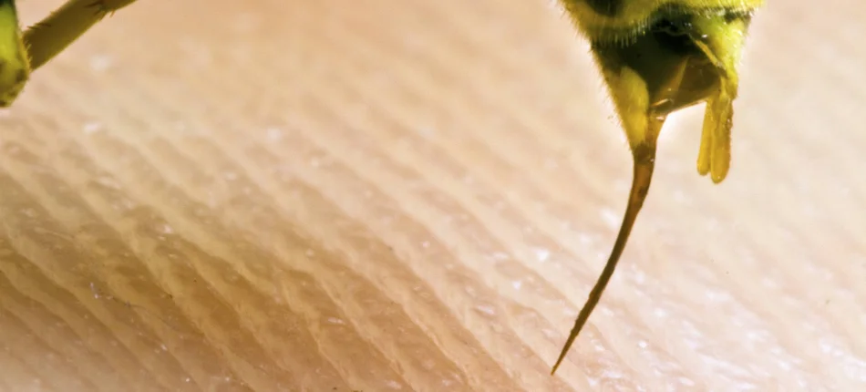 Alergia: Lęk przed użądleniem pszczoły czy osy zmienia życie pacjenta - Obrazek nagłówka