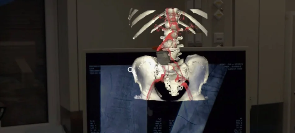 Pierwsza na świecie operacja aorty z wykorzystaniem hologramu - Obrazek nagłówka