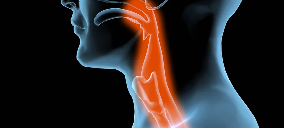 7 sposobów na ból gardła - Obrazek nagłówka