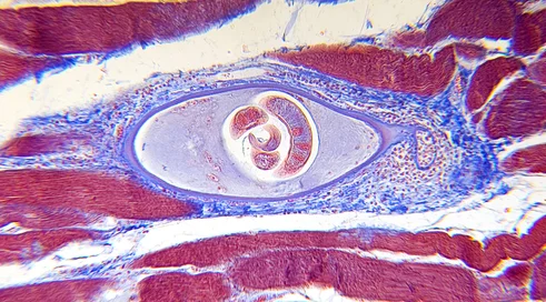 Microscope-Trichinella spiralis