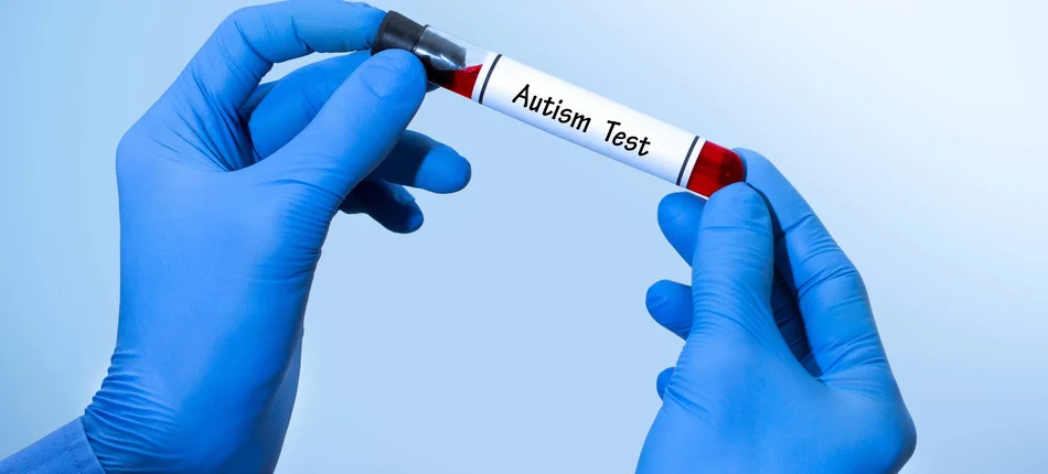 Autyzm: Potwierdzono wiarygodność testu z krwi - Obrazek nagłówka