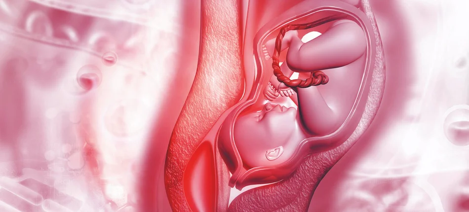 Postpartum hemorrhage: Prevention is crucial - Obrazek nagłówka