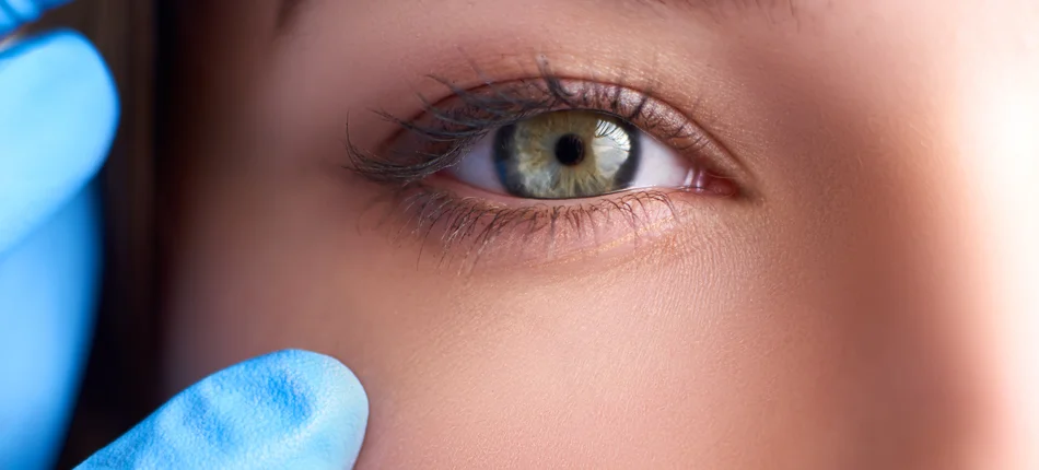 Nici PDO pod oczy: Innowacyjne rozwiązanie w estetyce medycznej - Obrazek nagłówka