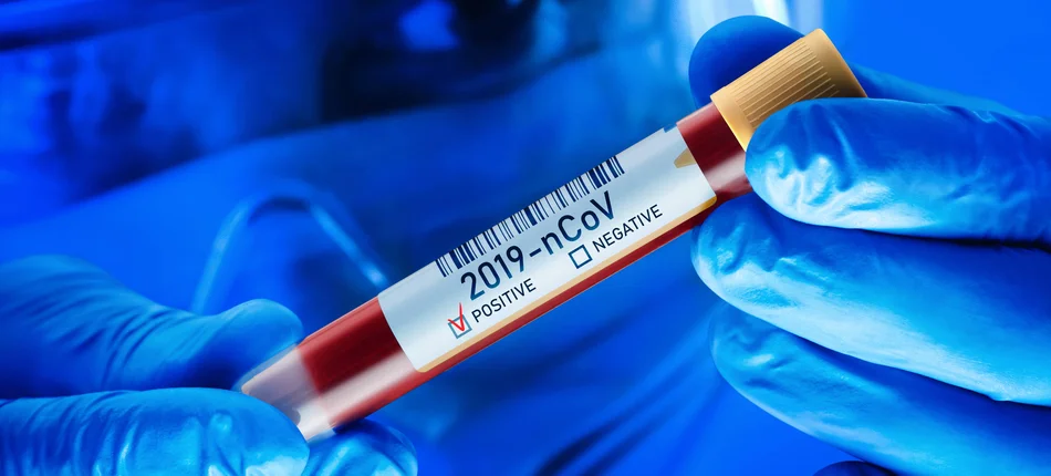 NFZ: zmiana w wycenie testów na koronawirusa - Obrazek nagłówka