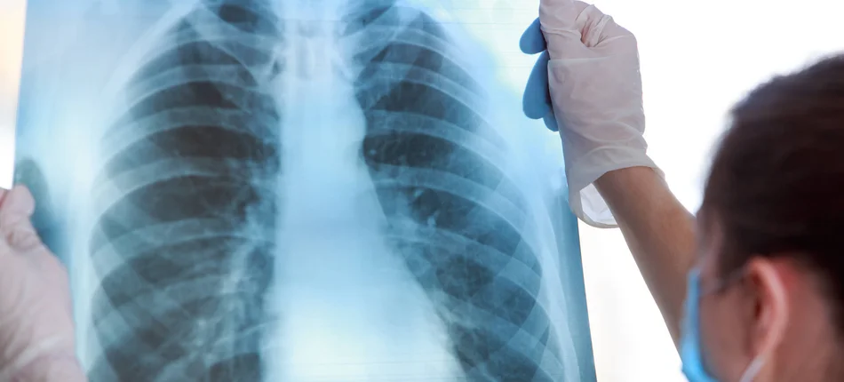 Samorząd oddychający pełnymi płucami - Obrazek nagłówka