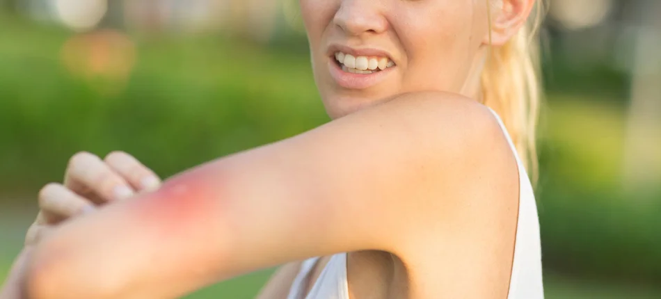Midges, mosquitos and ticks: How not to get bitten? - Header image