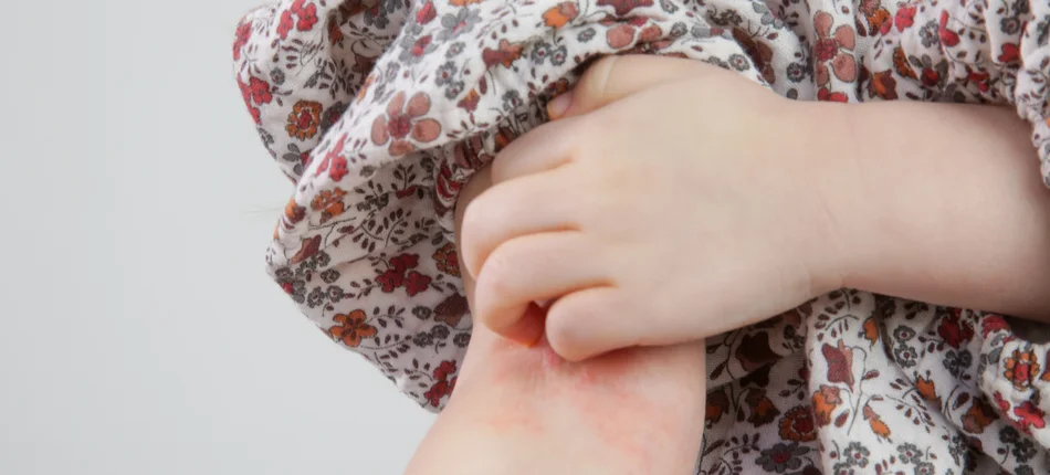 Polskie Towarzystwo Pediatryczne zaprasza na sympozjum naukowe „Dermatologia dla pediatrów” - Obrazek nagłówka
