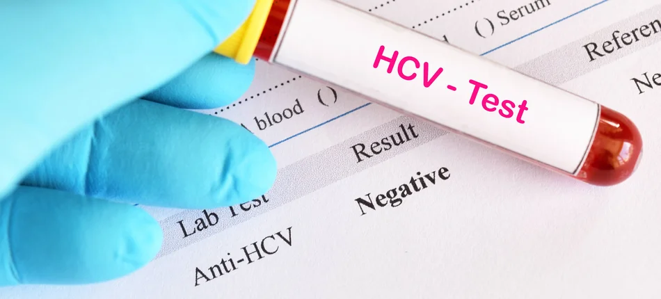 Testy na HCV od lipca dostępne bezpłatnie w POZ - Obrazek nagłówka