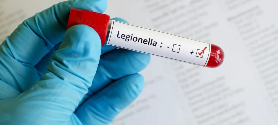 Legionella w kolejnych regionach. Potwierdzono zakażenia w Małopolsce i na Lubelszczyźnie - Obrazek nagłówka