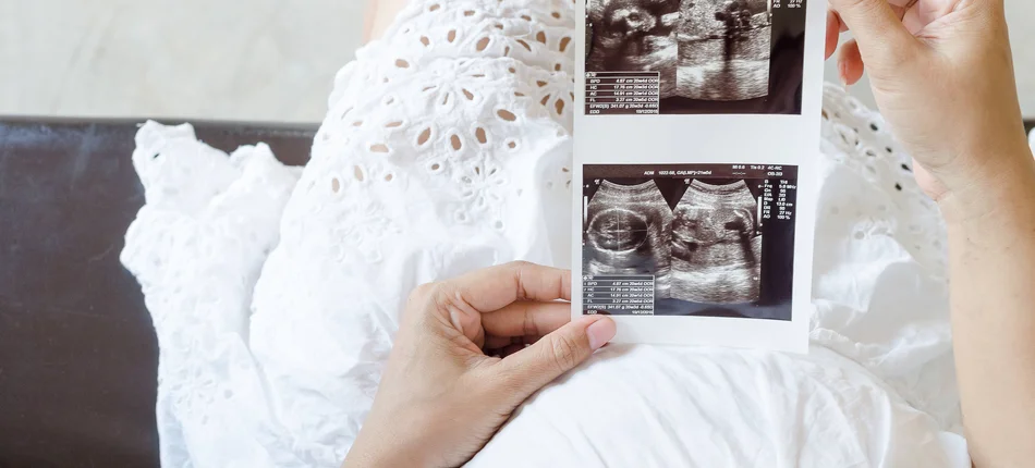 Niedobór biotyny w ciąży jest szkodliwy - Obrazek nagłówka