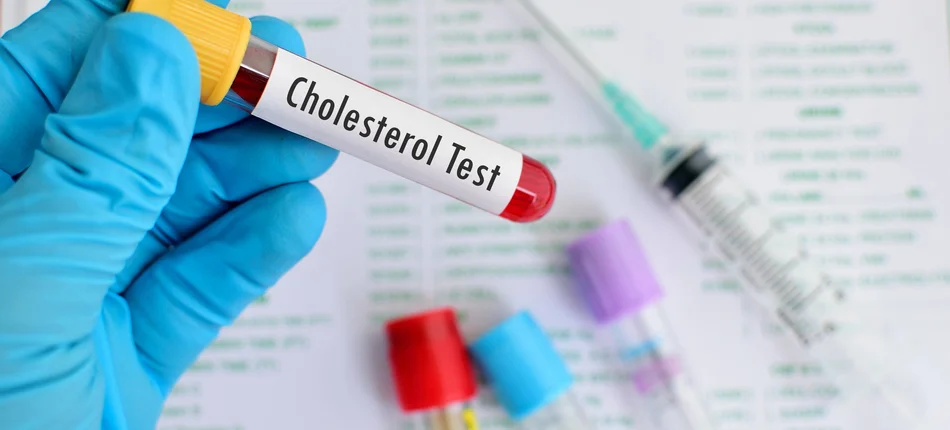 Ostrożnie z obniżaniem cholesterolu u diabetyków! - Obrazek nagłówka