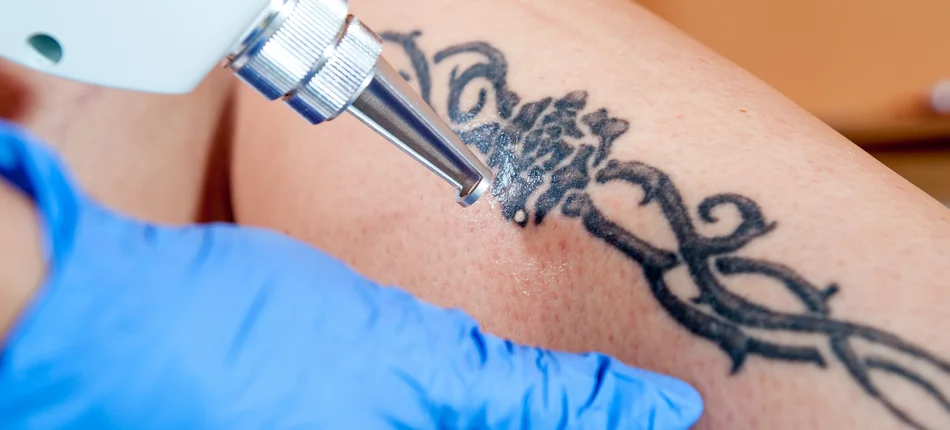 FDA zaniepokojona mikroorganizmami w tuszach do tatuaży - Obrazek nagłówka