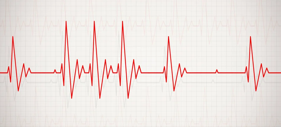 Najważniejsze pojęcia z zakresu zaburzeń rytmu serca - Obrazek nagłówka