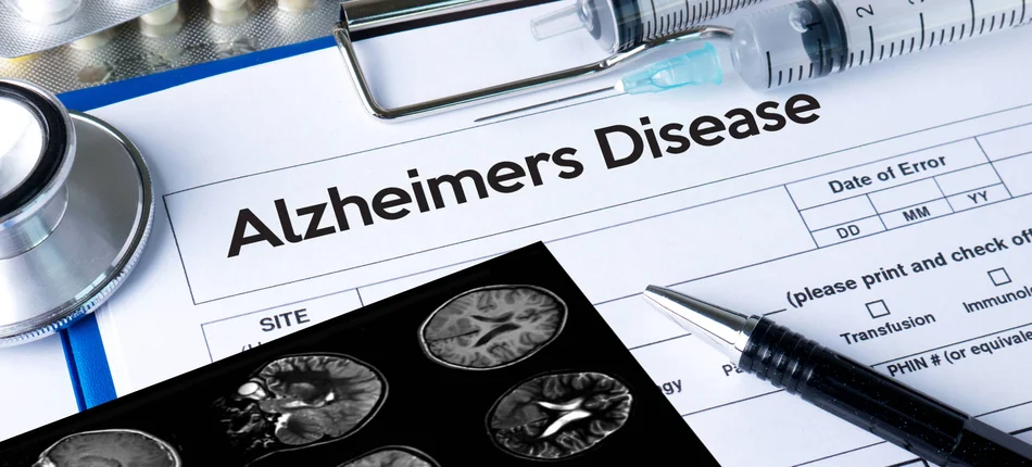 Przełom w leczeniu Alzheimera: neurolodzy do terapii podchodzą bez entuzjazmu - Obrazek nagłówka