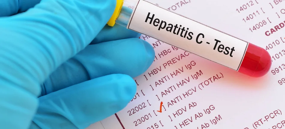 HCV: Leki czekają na pacjenta a niezdiagnozowanych osób jest ok. 150 tysięcy - Obrazek nagłówka
