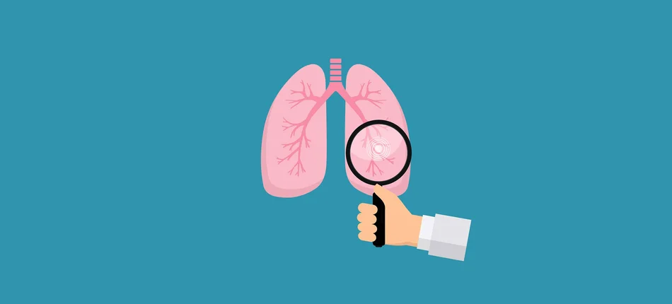W 2019 roku ruszy program wczesnego wykrywania raka płuca - Obrazek nagłówka