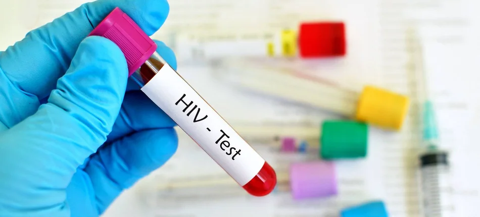 Europejski Tydzień Testowania na HIV - Obrazek nagłówka