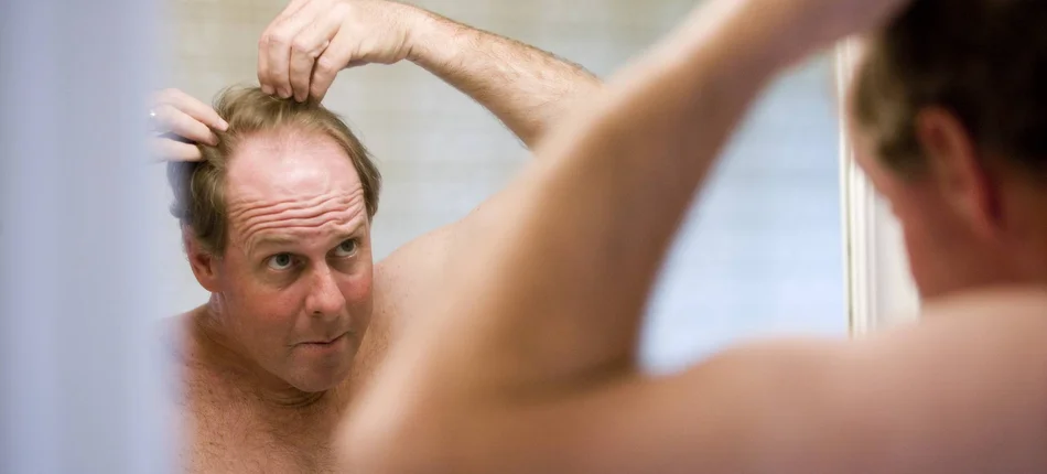 Leki na łysienie i na przerost prostaty mogą wywołać impotencję - Obrazek nagłówka