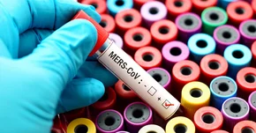 Obiecująca metoda walki z niebezpiecznym wirusem MERS-CoV