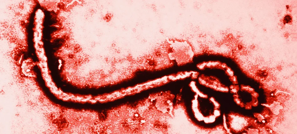 GIS: informacja dla lekarzy POZ i służb medycznych w przypadku podejrzenia wirusa Ebola - Obrazek nagłówka