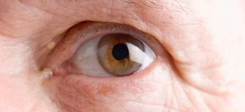 Jak skuteczniej zapobiegać utracie wzroku u diabetyków - Obrazek nagłówka