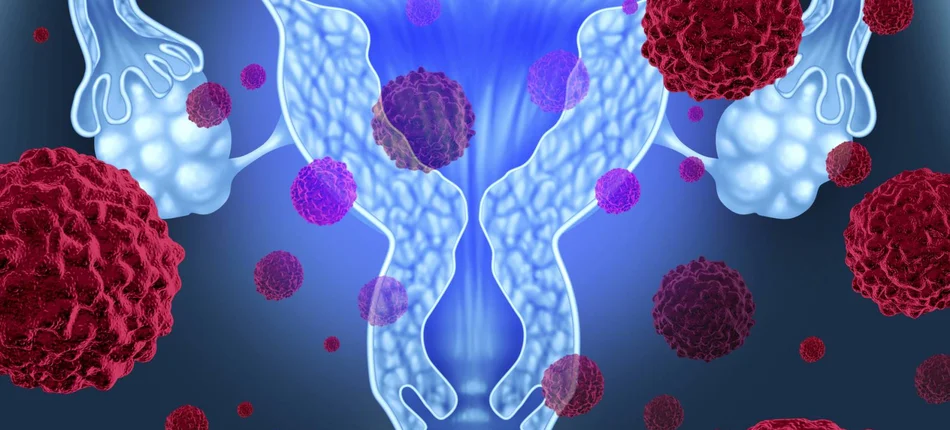 Pierwsza terapia biologiczna w leczeniu zaawansowanego raka szyjki macicy - Obrazek nagłówka