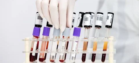 Rozporządzenie w sprawie szkoleń diagnostów laboratoryjnych - Obrazek nagłówka