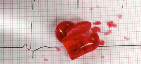Czy Polscy naukowcy przyczynią się do przełomu w diagnostyce niewydolności serca ? - Obrazek nagłówka