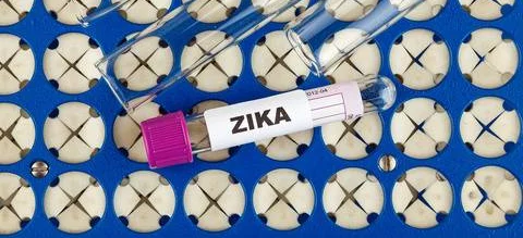 Kolejny przypadek przeniesienia wirusa Zika drogą płciową - Obrazek nagłówka
