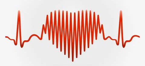 Nowe wytyczne dotyczące diagnostyki i leczenia ostrej i przewlekłej niewydolności serca - Obrazek nagłówka