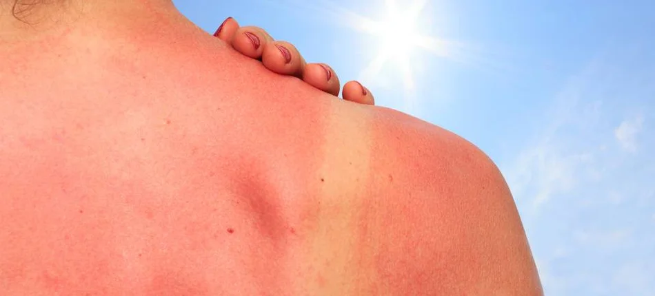 Phone overlay will help detect skin cancer - Header image