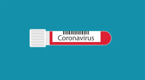 koronawirus-3