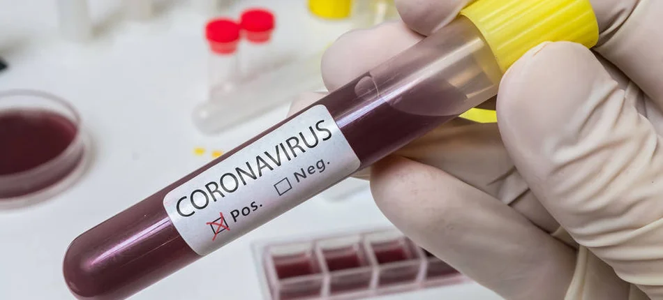Ilu lekarzy zakażonych koronawirusem zgłosiło się w poniedziałek do OIL? - Obrazek nagłówka
