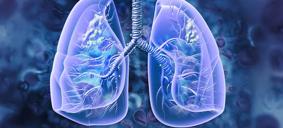 A new therapeutic option for NSCLC patients - Header image