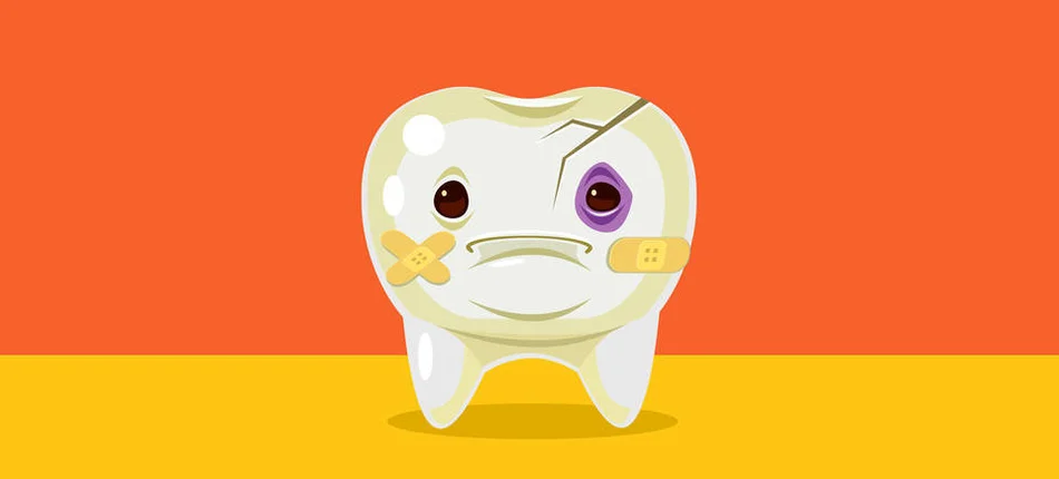 Tooth trauma. What next? - Header image